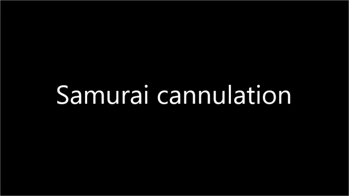 Samurai Cannulation